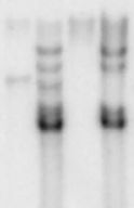 Southern-Blot-Autoradiogramm